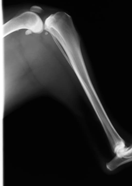 前十字靭帯断裂手術前のレントゲン写真