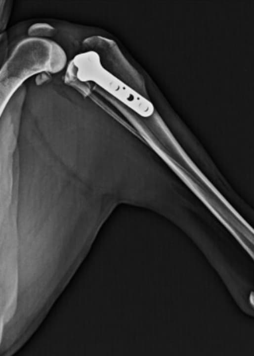 前十字靭帯断裂手術後のレントゲン写真