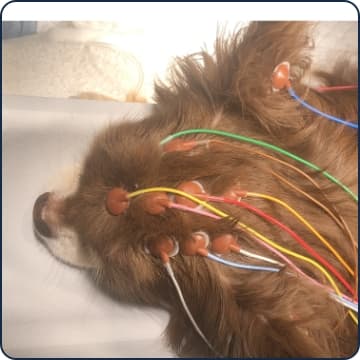 実際にEEGを使用している様子