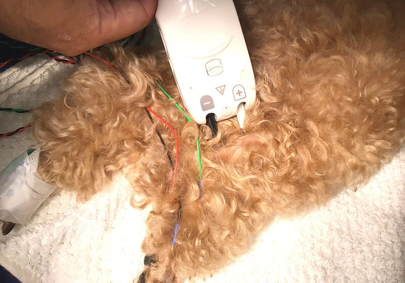 筋電図の使用イメージ