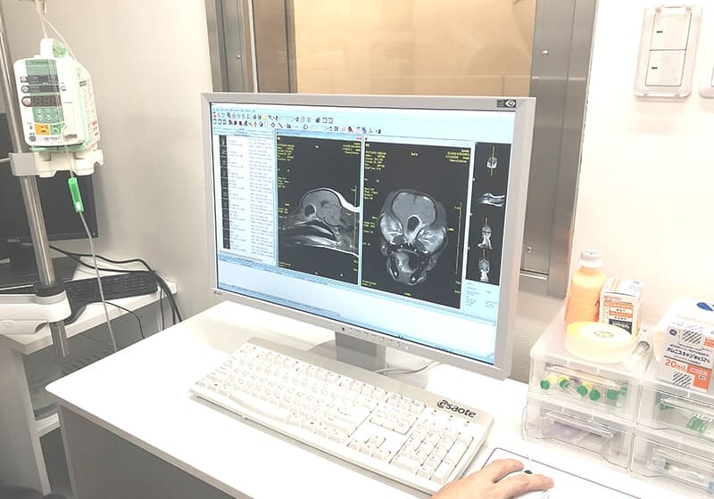 MRIの撮影データ