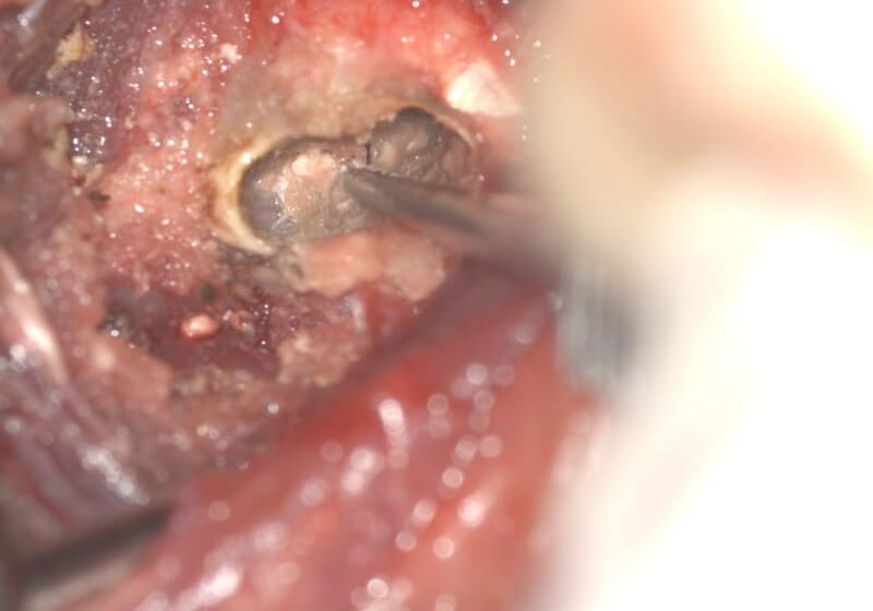 顕微鏡による写真2